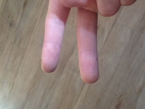 Finger